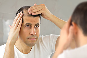 Common Reasons of Hair Loss