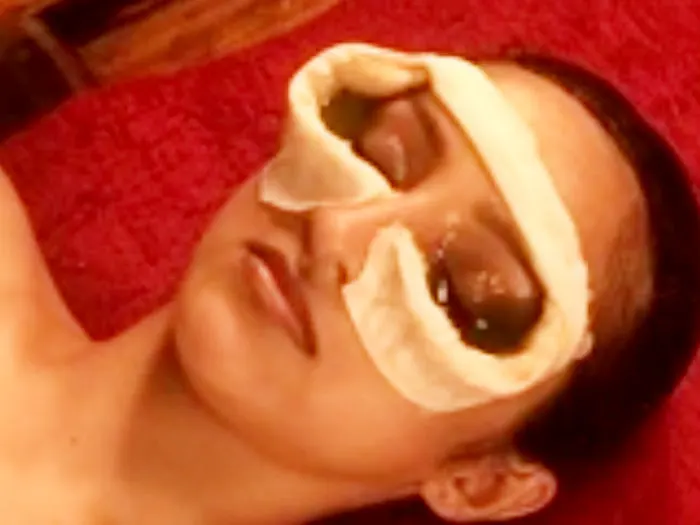 Netra Tharpanam Ayurvedic Treatment Video