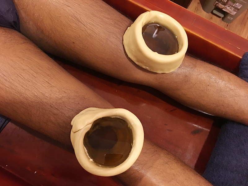 Januvasti Ayurvedic Knee Pain Treatment